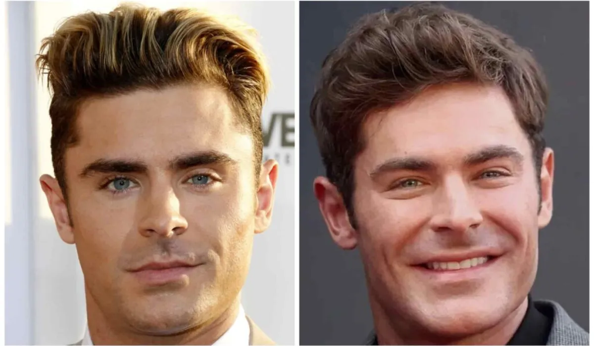 Zac Efron Hair Transplant