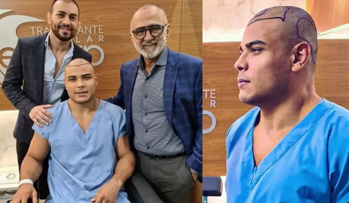 paulo costa hair transplant