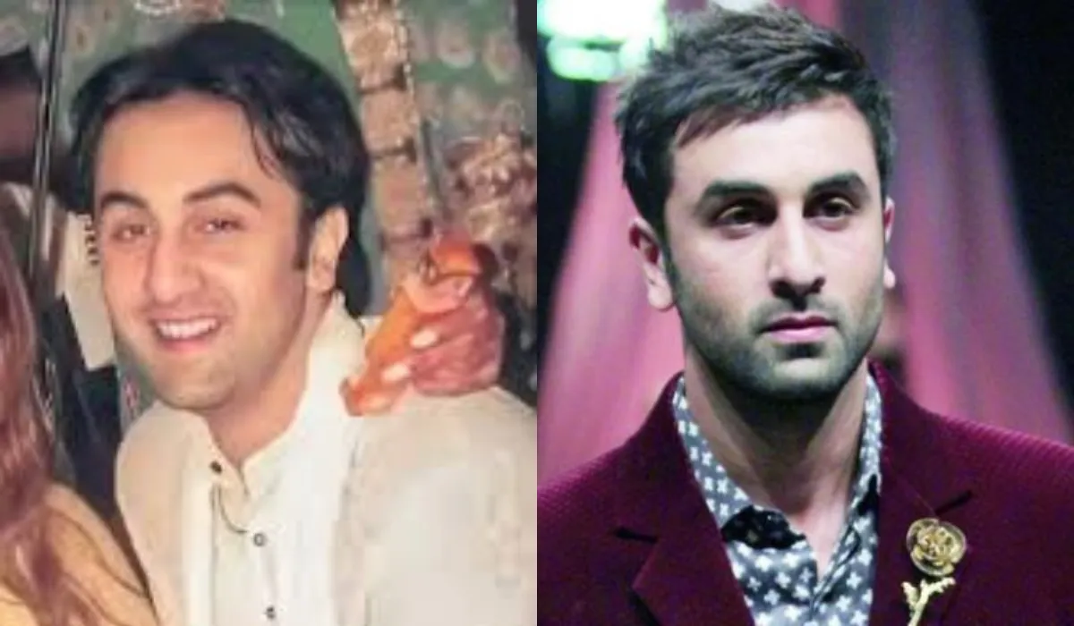 ranbir kapoor hair transplant