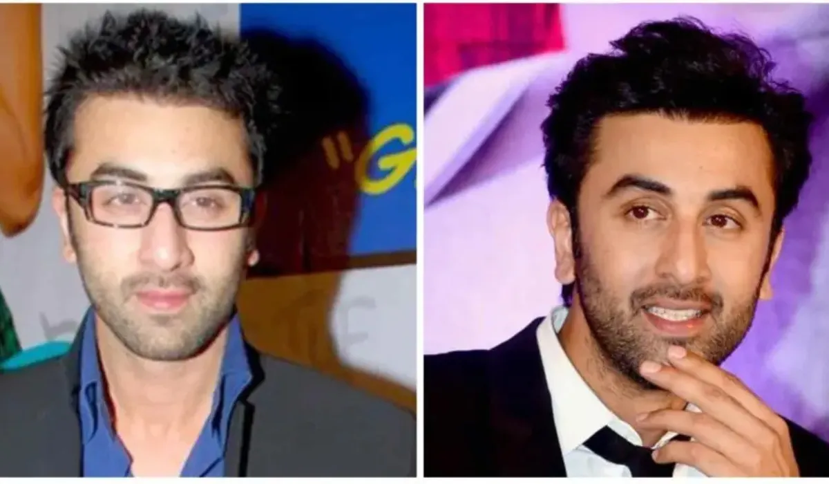 ranbir kapoor hair transplant