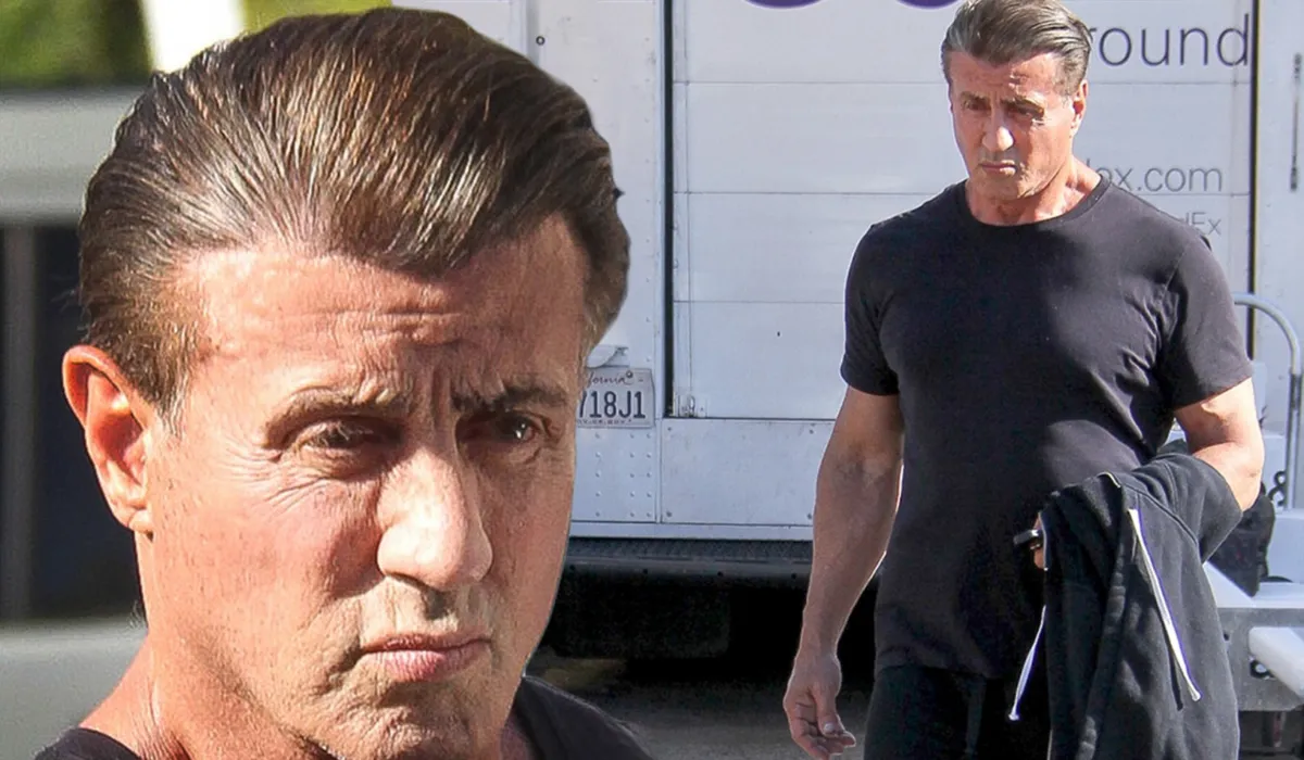 Sylvester Stallone Hair Transplant Before and After