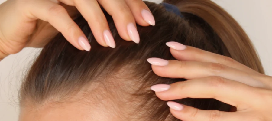 Brittle Hair Loss vs Hair Thinning