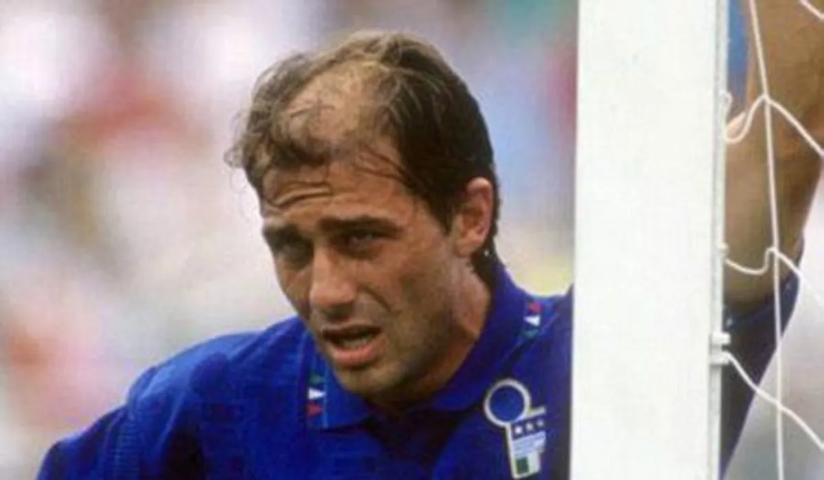 Antonio Conte Hair Transplant