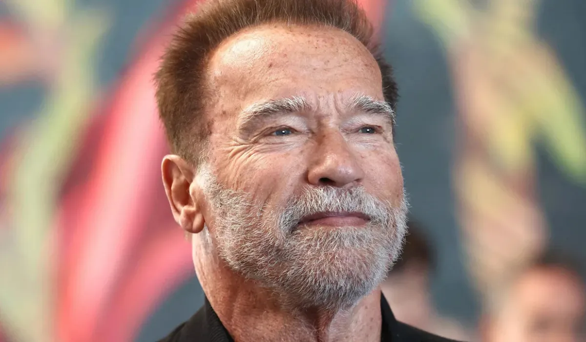 Arnold Schwarzenegger Hair Transplant