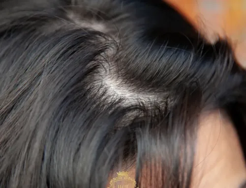 Die besten Frisuren für dünner werdendes Haar