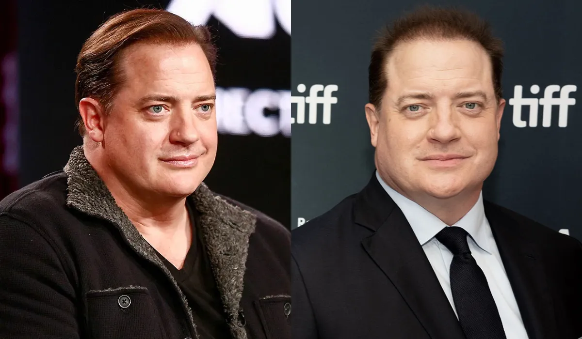 Brendan Fraser Hair Transplant