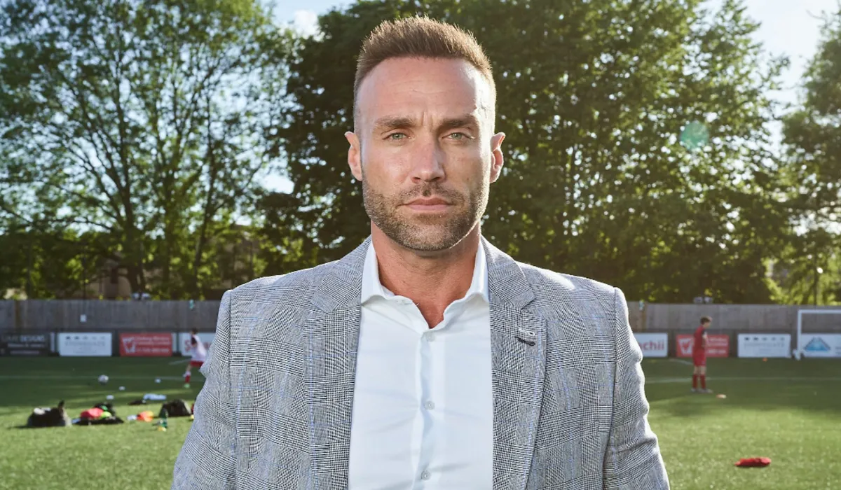 Calum Best Hair Transplant