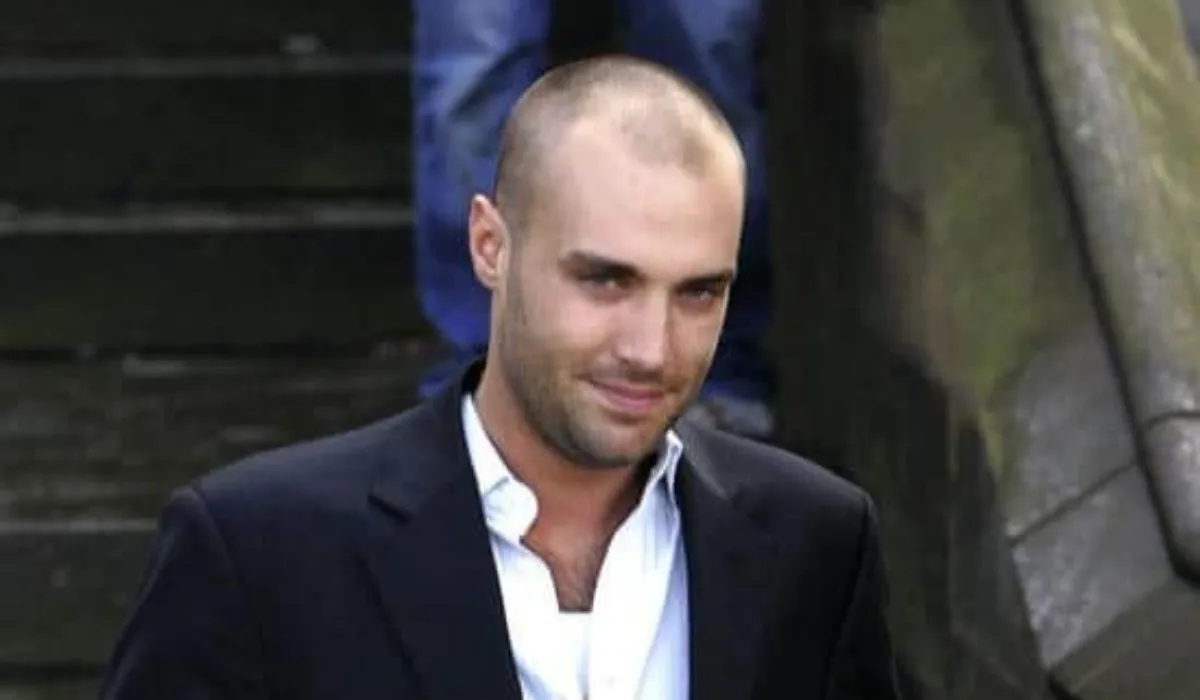 Calum Best Hair Transplant