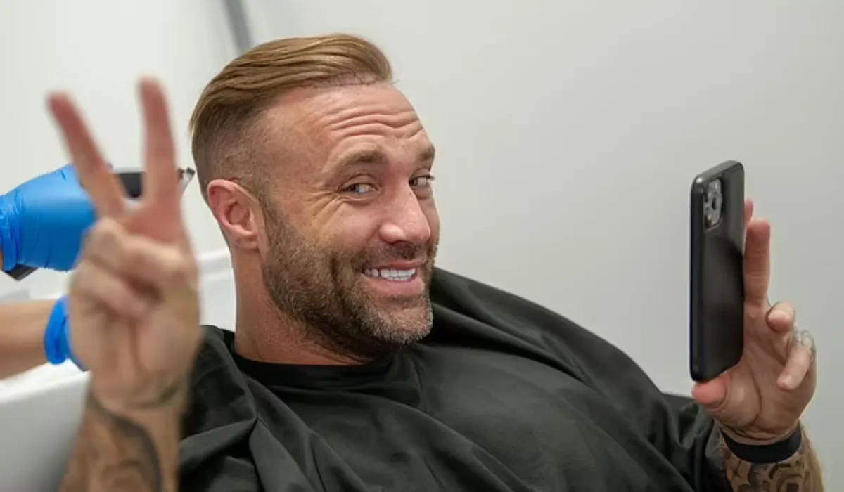 Calum Best Hair Transplant