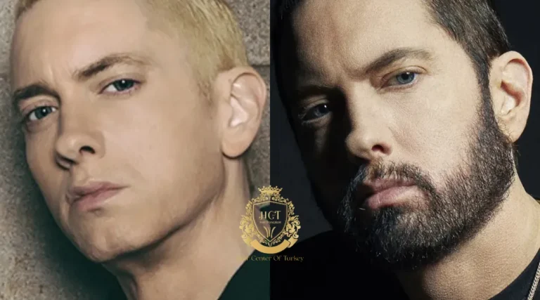 Trasplante capilar de Eminem