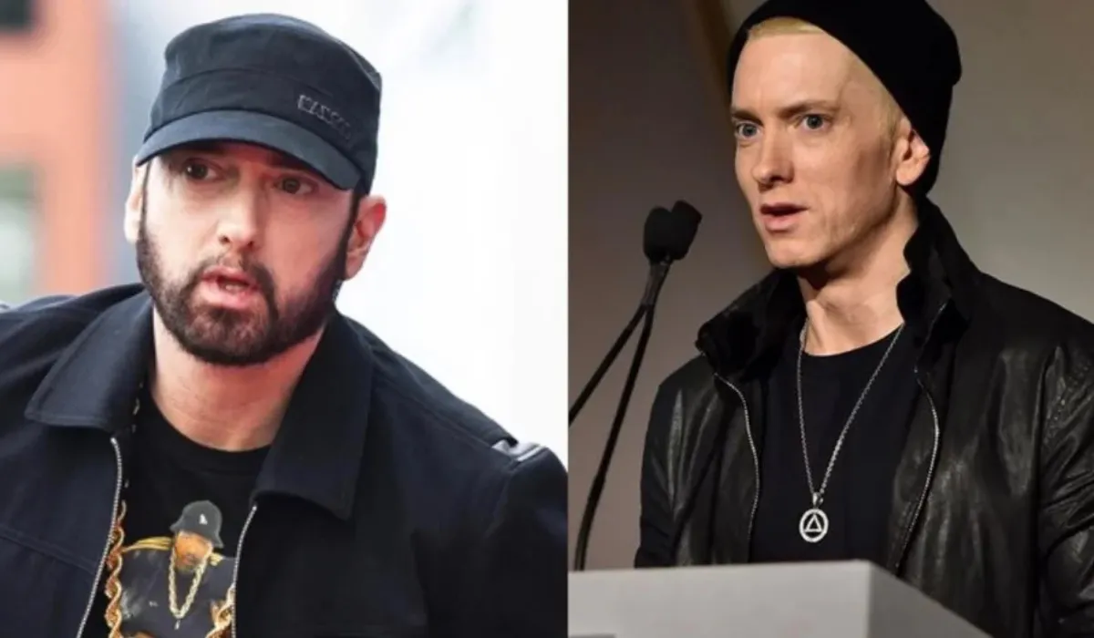 Eminem Hair Transplant 