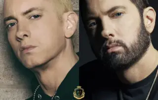 Eminem Hair Transplant