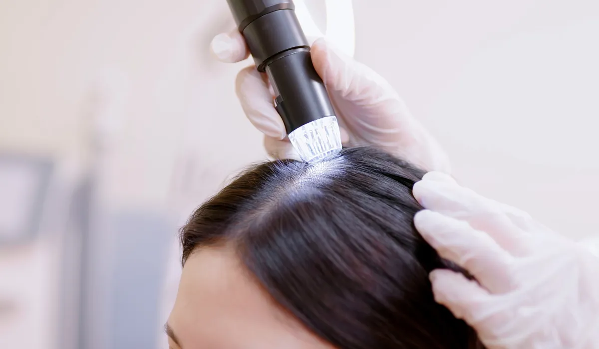 Emotional Stress on Hair Loss