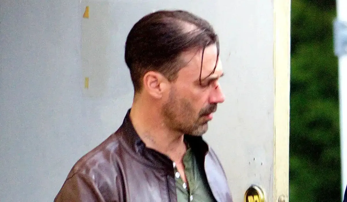 Jon Hamm Hair Transplant