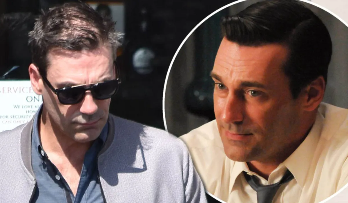 Jon Hamm Hair Transplant