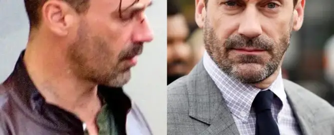 Jon Hamm Hair Transplant