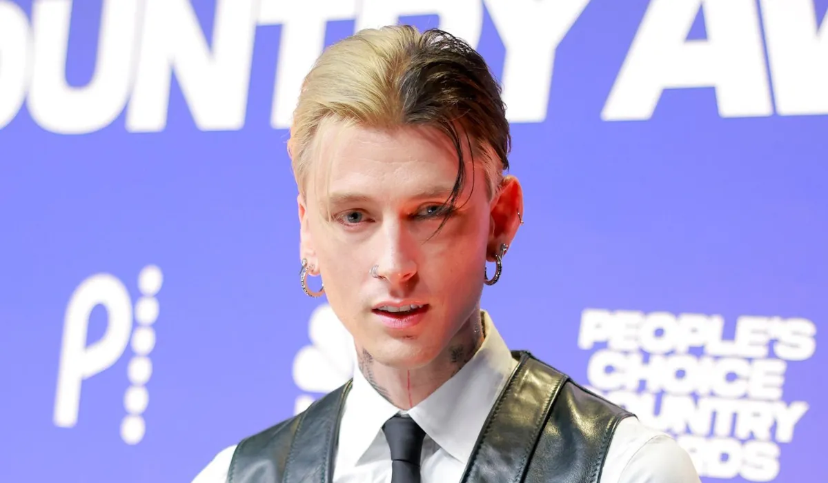 MGK Hair Transplant