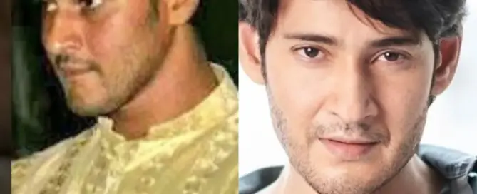 mahesh babu Hair Transplant