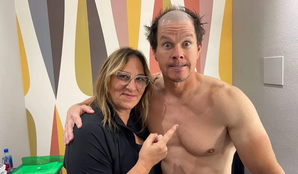 Mark Wahlberg Hair Transplant