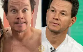 Mark Wahlberg Hair Transplant