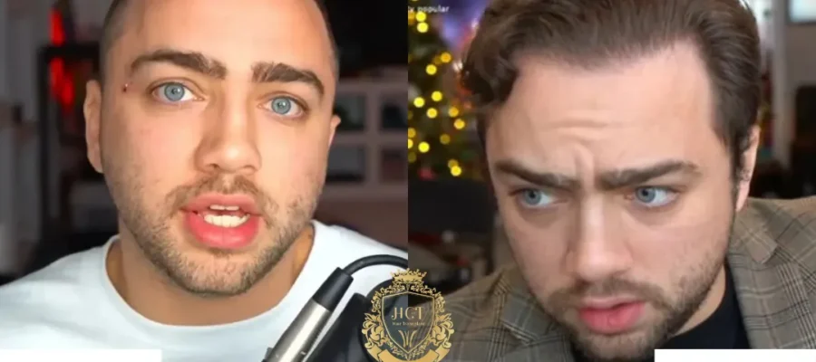 Mizkif (Matthew Rinaudo) Haartransplantation
