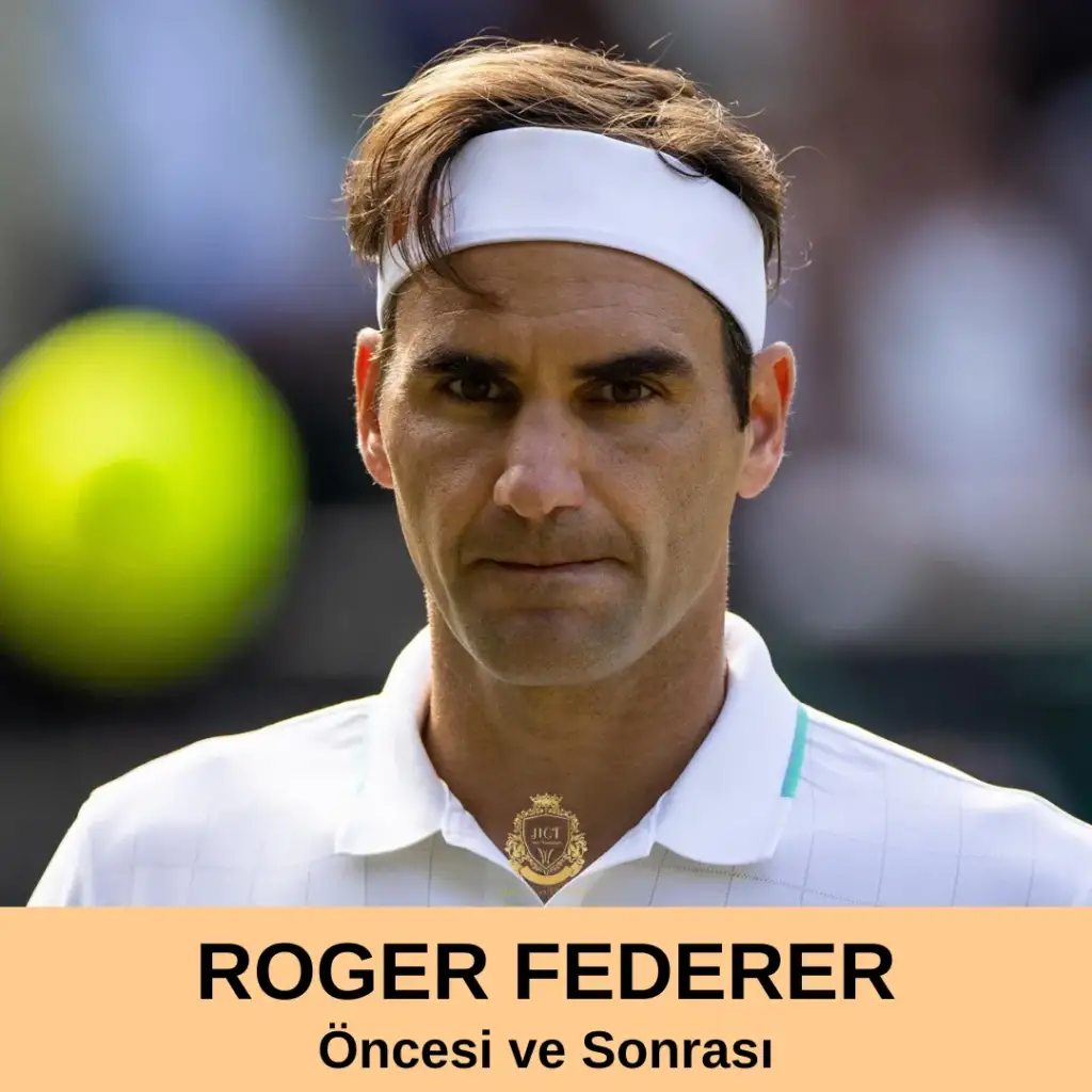 Roger Federer Saç Ekimi