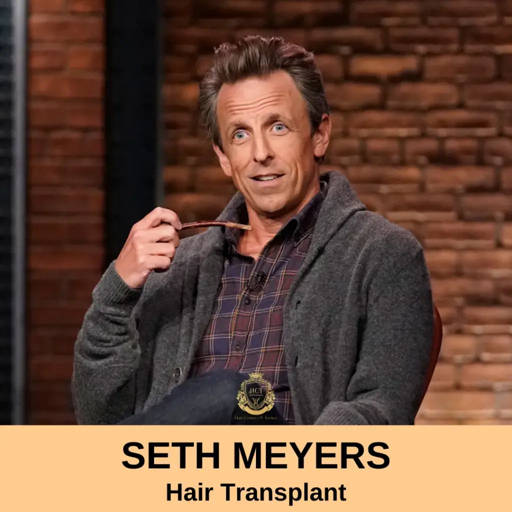 Seth Meyers Hair Transplant