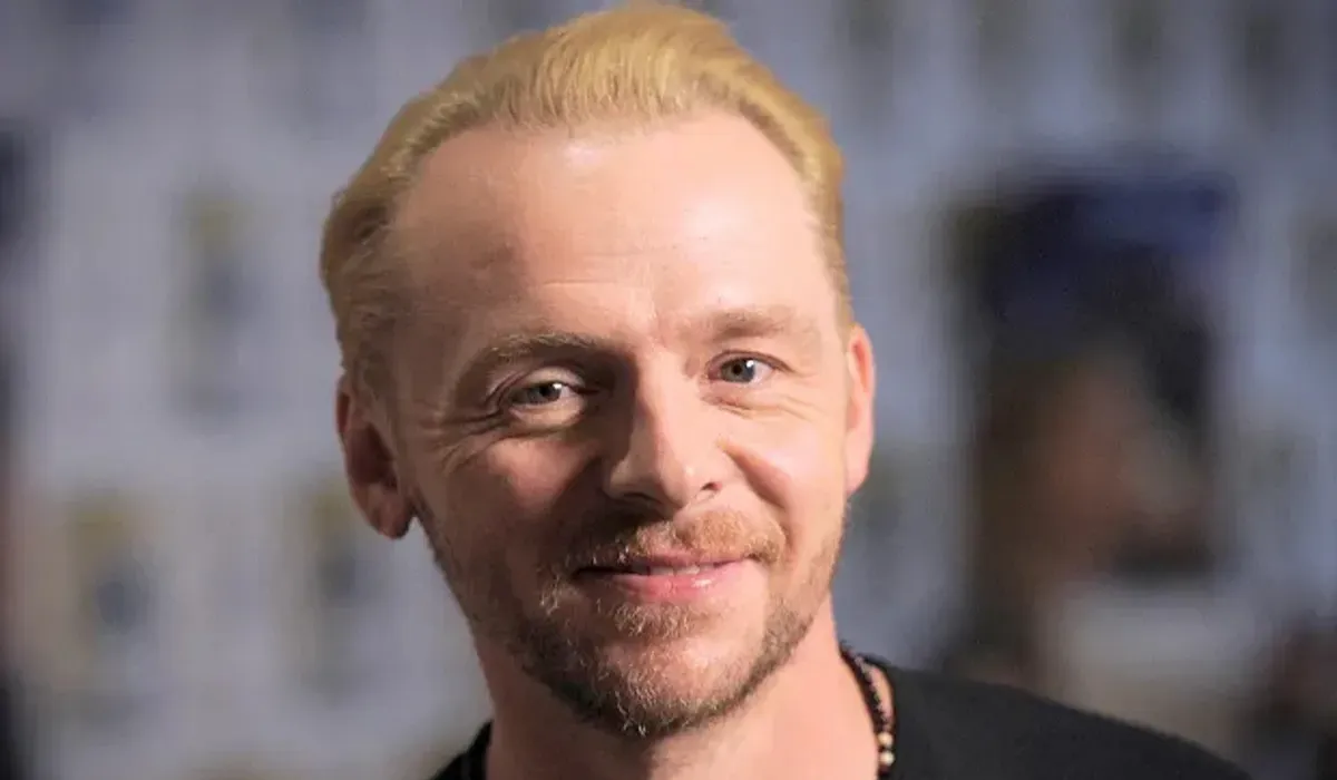 Simon Pegg Hair Transplant