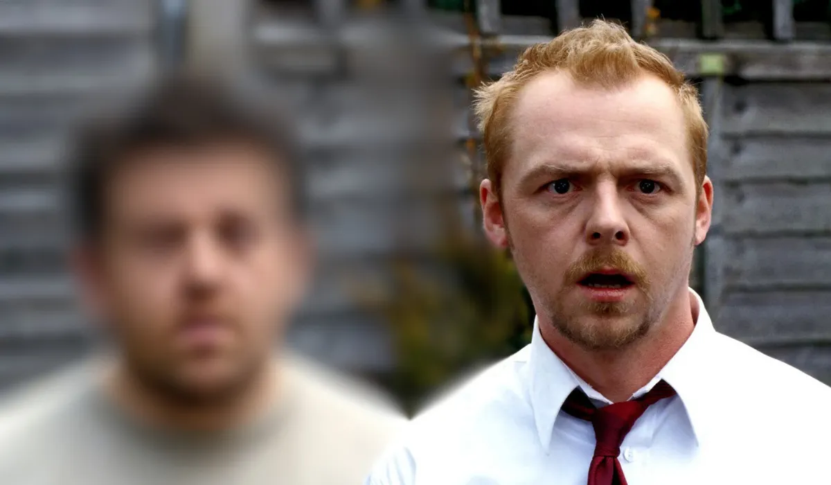 Simon Pegg Hair Transplant