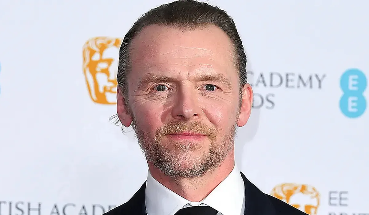 Simon Pegg Hair Transplant