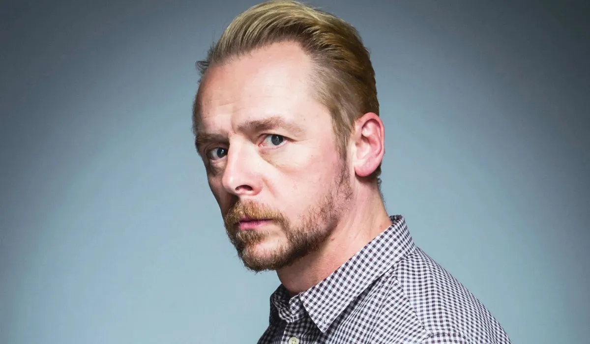 Simon Pegg Hair Transplant