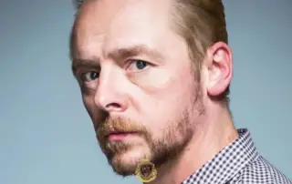 Simon Pegg Hair Transplant