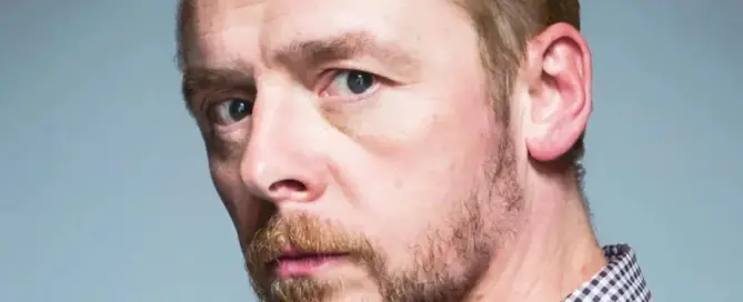 Simon Pegg Hair Transplant