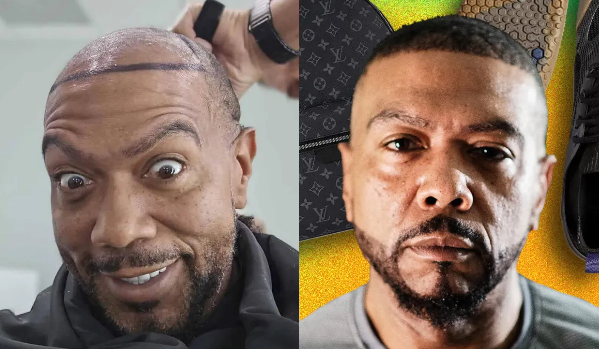 Timbaland Hair Transplant