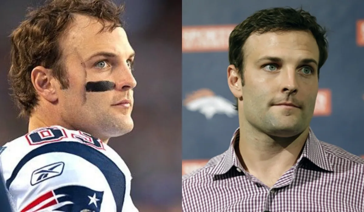 Wes Welker Hair Transplant