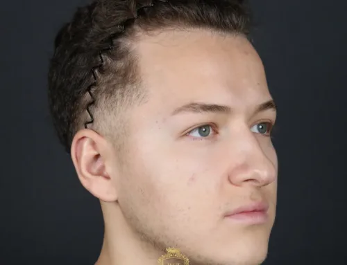 Die besten Frisuren für zurückgehendes Haar