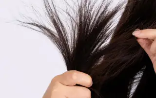 brittle hair and hair thinning