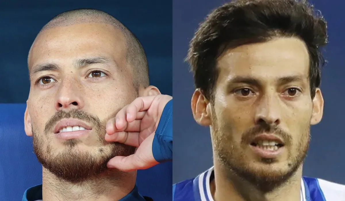 david silva Hair Transplant