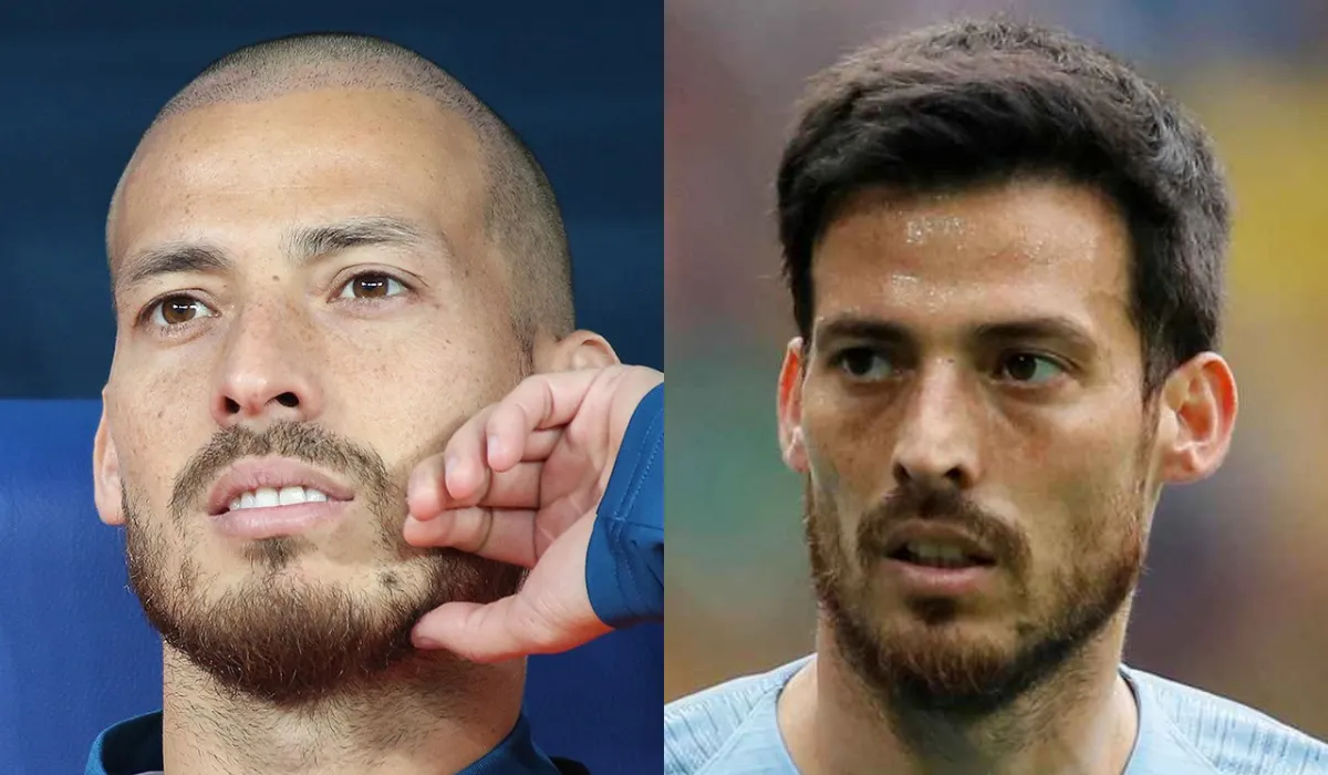 david silva Hair Transplant