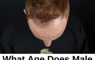 What Age Does Male Pattern Baldness