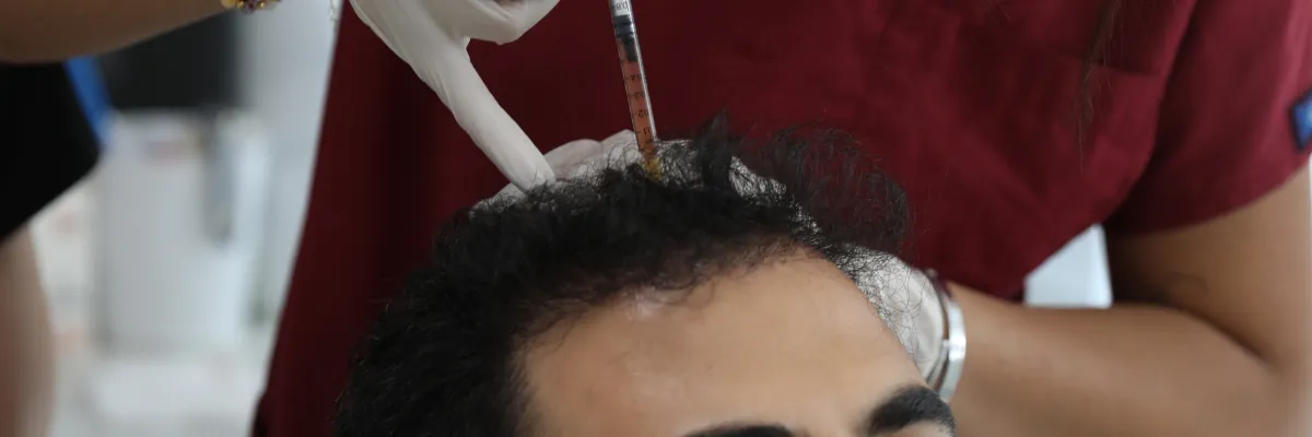 crown hair loss