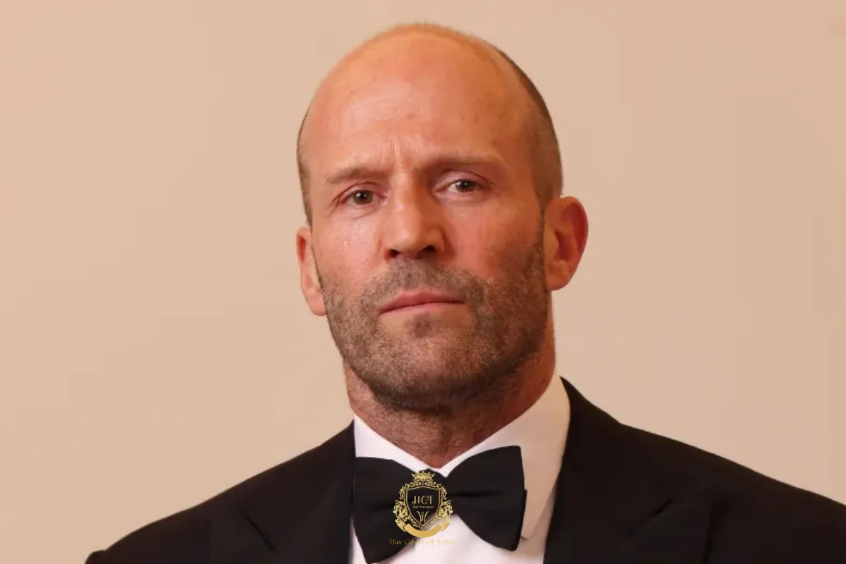 Bald Movie Actors 60 Photos Moonagedaydream film