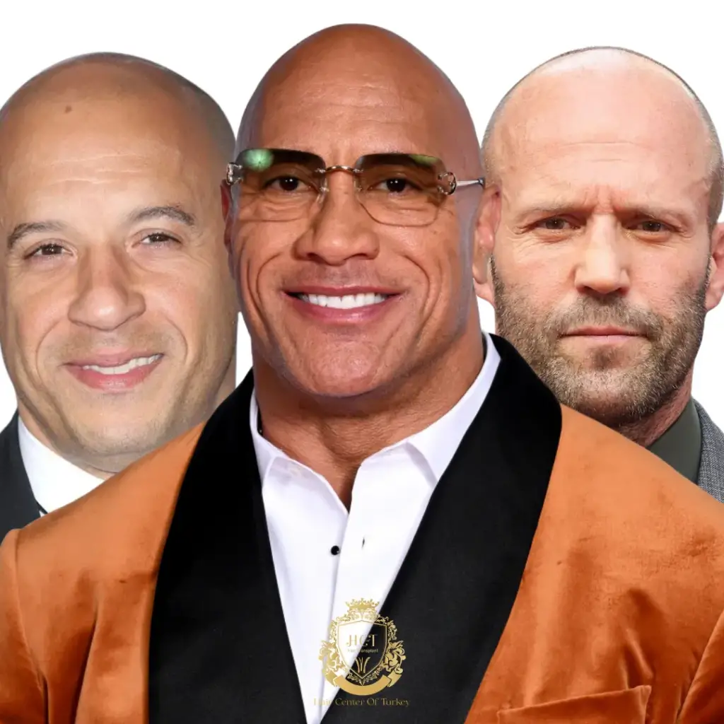 famous bald actors