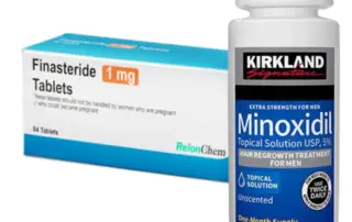 finasteride vs minoxidil