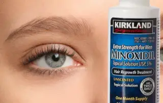 minoxidil for eyebrow