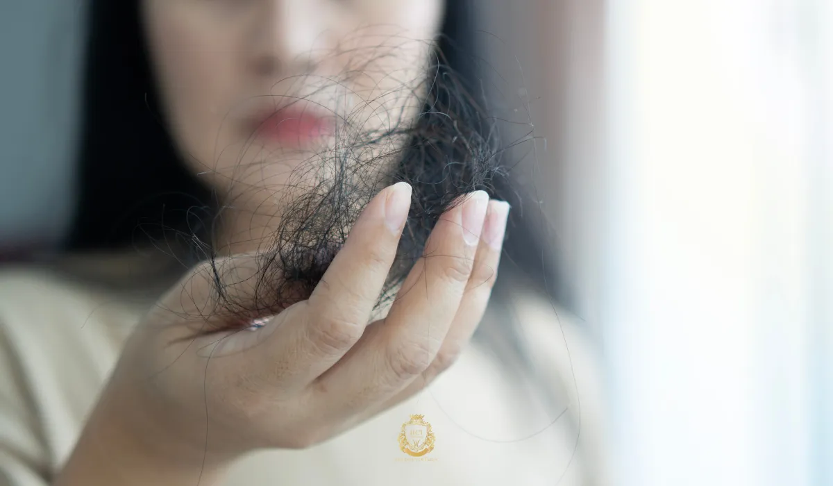 receding hairline in woman