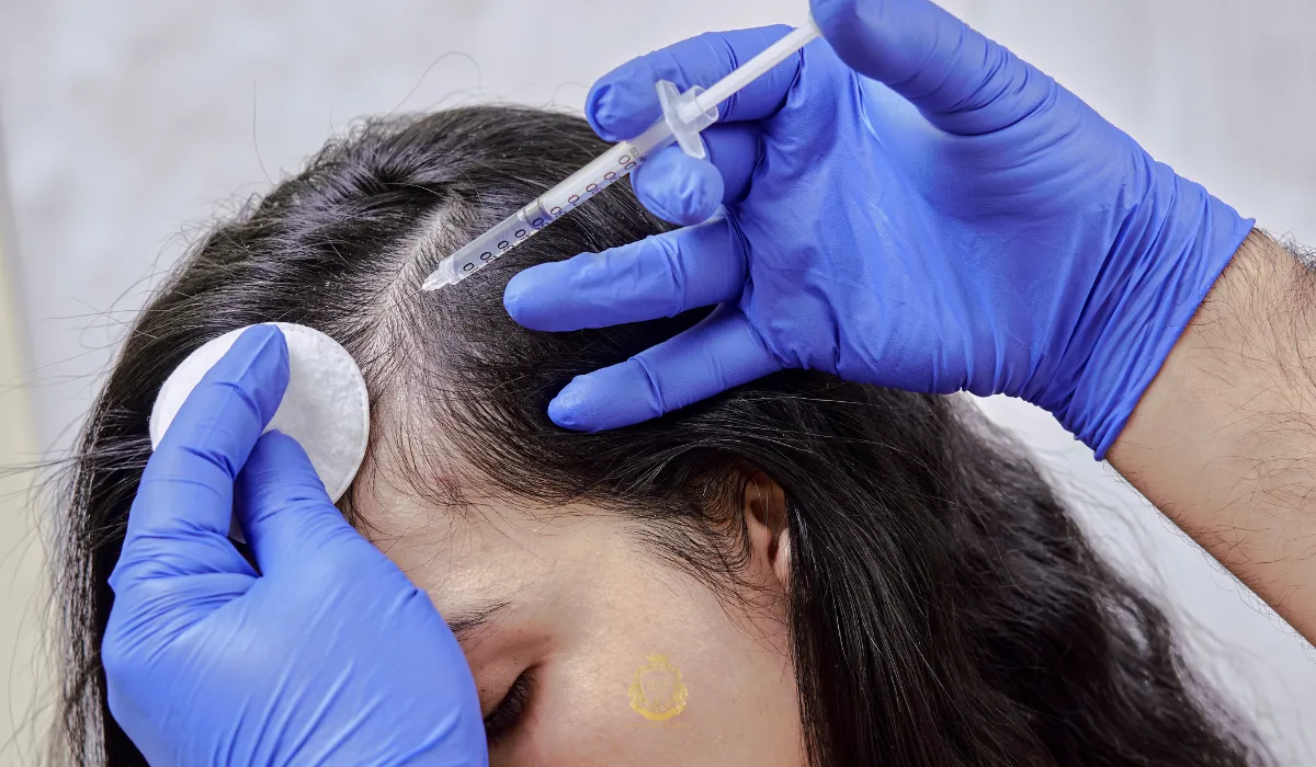 receding hairline in woman