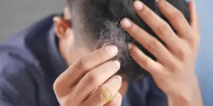 finasteride shedding