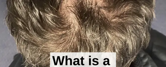 What is a Double Crown