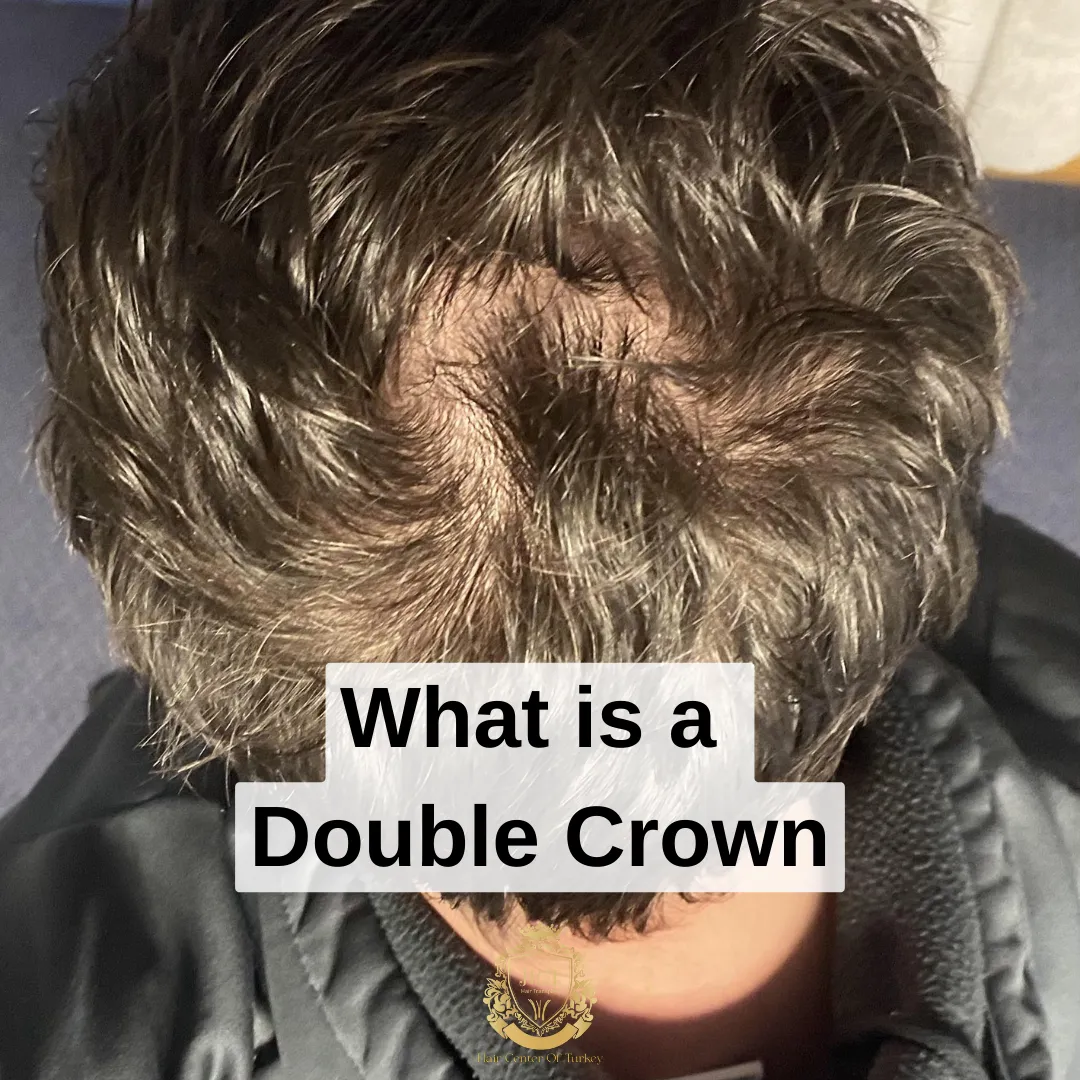 What is a Double Crown